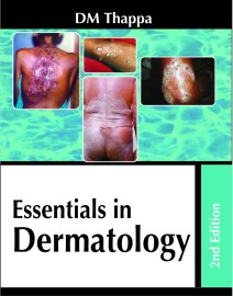 Essentials in Dermatology