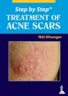 Step by Step Treatment of ACNE Scars