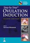 Step by Step Ovulation Induction