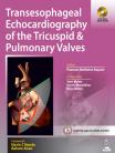 Transesophageal Echocardiography of the Tricuspid & Pulmonary Valves