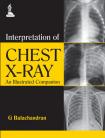 Interpretation of Chest X-Ray An Illustrated Companion