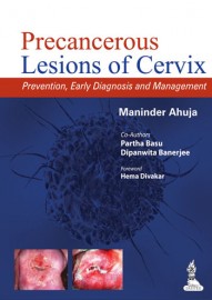Precancerous Lesions of Cervix Prevention  Early Diagnosis and Management