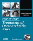 Step by Step Treatment of Osteoarthritis Knee with DVD Rom