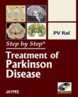 Step by Step Treatment of Parkinson Disease
