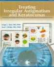 Treating Irregular Astigmatism and Keratoconus 