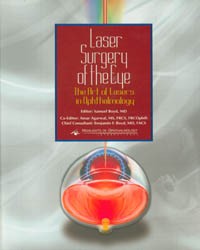 Laser Surgery of the Eye