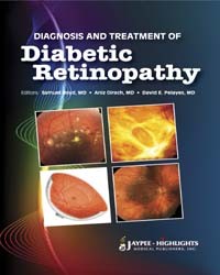 Diagnosis and Treatment of Diabetes Retinopathy