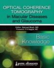 Optical Coherence Tomography in Macular Diseases and Glaucoma - Basic Knowledge