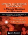 Optical Coherence Tomography in Macular Diseases and Glaucoma: Advanced Knowledge